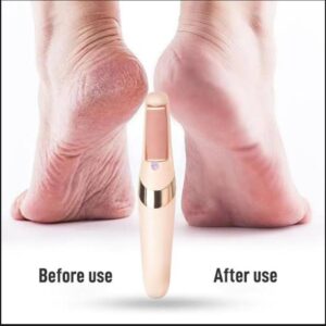 Rechargeable Electric Foot File Callus Remover